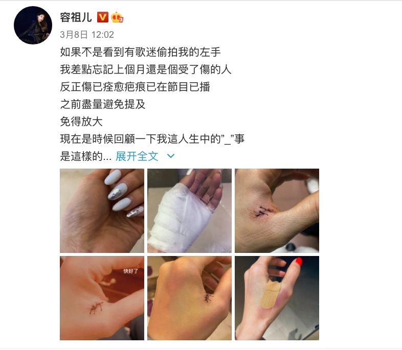 容祖兒Gel「長甲」變廢人釀意外,因美甲行動不便被剪刀誤傷虎口2