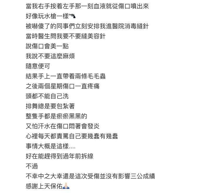 容祖兒Gel「長甲」變廢人釀意外,因美甲行動不便被剪刀誤傷虎口2