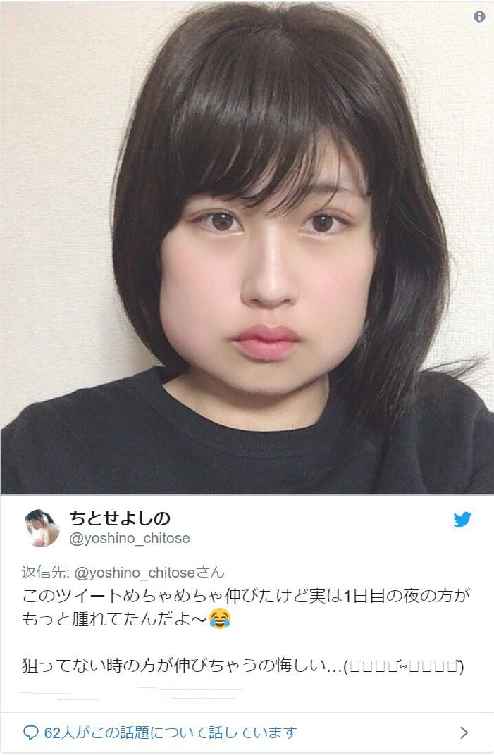 日本爆紅「智慧齒美女」!剝智慧齒零P圖照曝光,雙手拿開視覺衝擊!