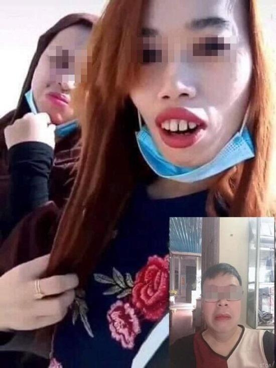 【網戀分手】女友露出了超驚人的一排暴牙,上排的牙縫也明顯略大,這時男友的表情已經嚇到臉容扭曲