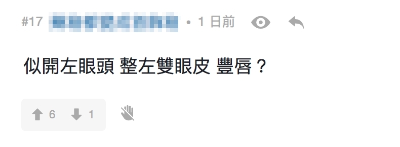 有網民就認為張寶兒最大的變化是現時雙眼皮深邃,與初出道時內雙眼皮的樣子判若兩人,質疑她開了眼頭