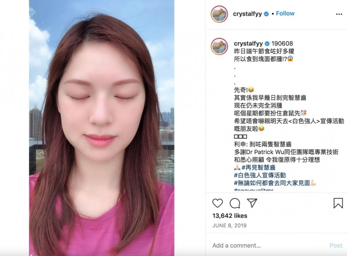 因此,牙醫普遍建議大家應該及早評估智慧齒的生長情況,看看是否有需要拔除~