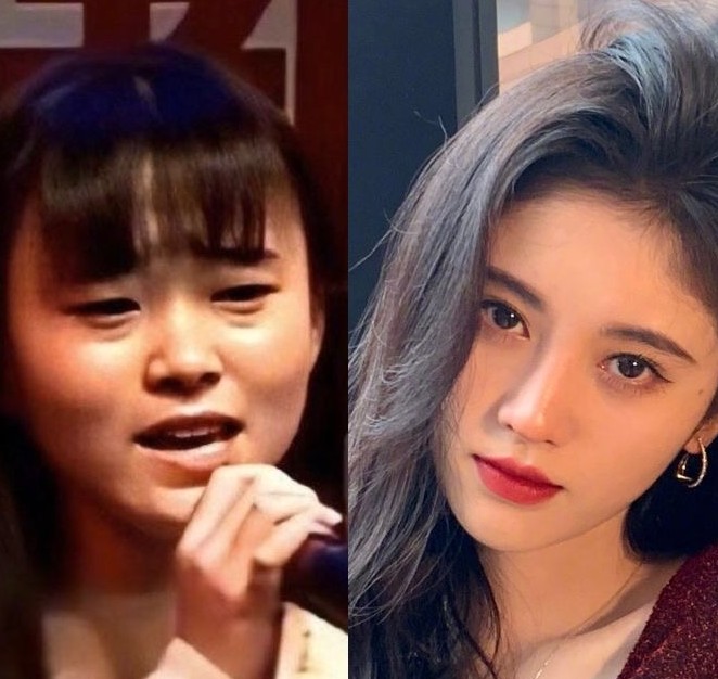 -四千年一遇美女-鞠婧禕-整容過度-女神-9