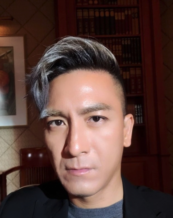 近日馬明就為《白色強人2》拍攝外景興奮曬出合照,不過成為眾人焦點的竟然是他的 All Back 高髮線?