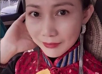女子在3年前曾接受過面部吸脂手術,她天生擁有一張童顏臉