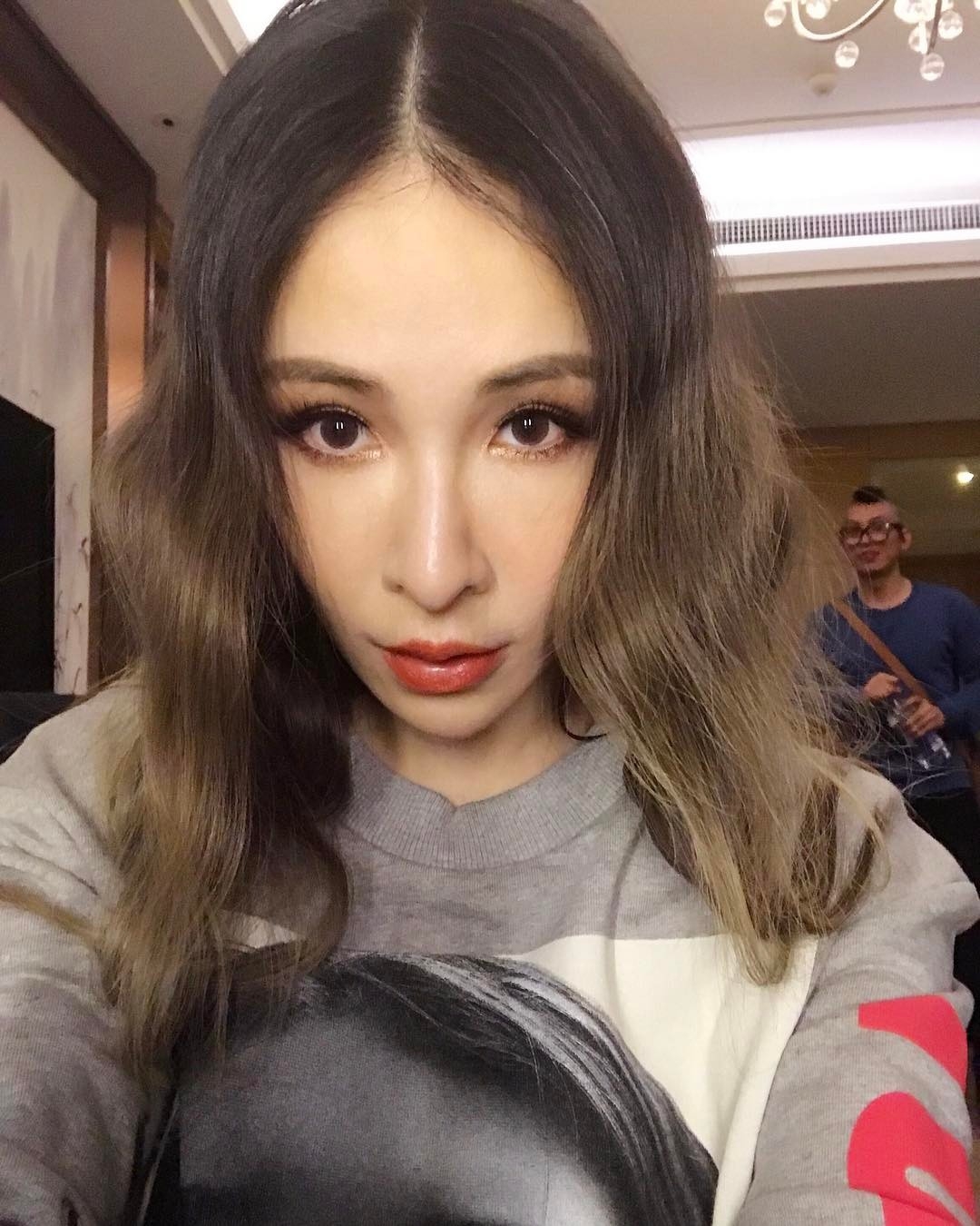 蕭亞軒公開被狗咬傷後臉上疤痕,大愛回應:無責怪狗狗,莫對領養有疑慮