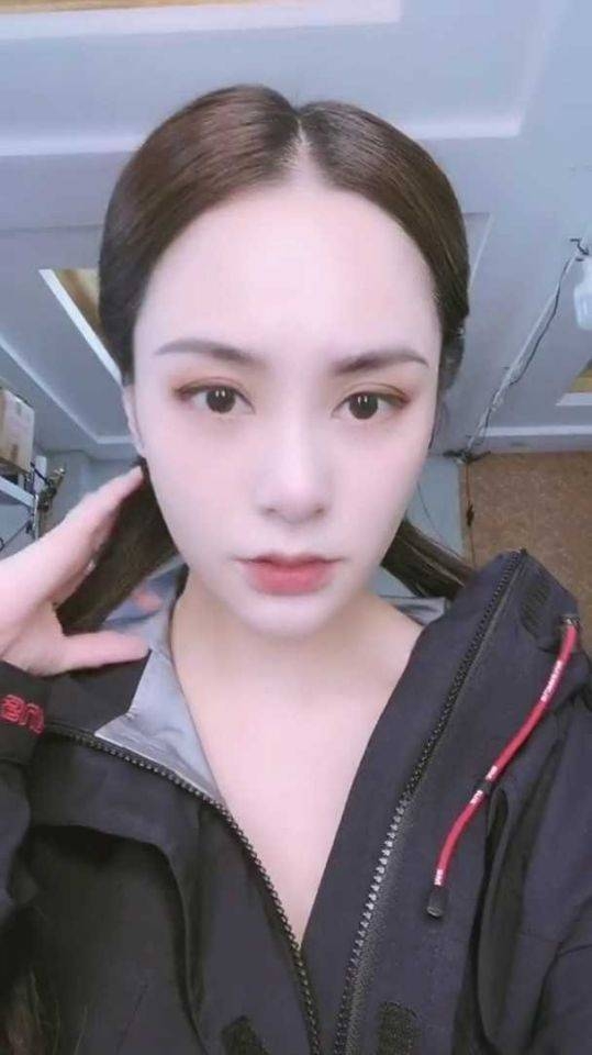 鍾欣潼阿嬌之前在内地拍劇時,就不小心在酒店房内撞傷了右眉骨,傷口達6cm長,最後要縫數十針
