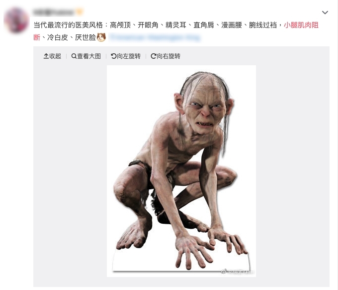 小腿肌肉阻斷,瘦小腿,蘿蔔腳,肌肉腿