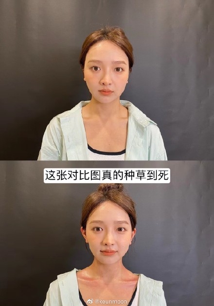 大陸整容新潮流「精靈耳」,KOL風靡打針改耳型變阿凡達?網民嘆:容貌焦虑連耳仔都唔放過