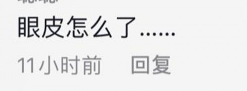 唐詩詠-抖音-整容-雙眼皮-479