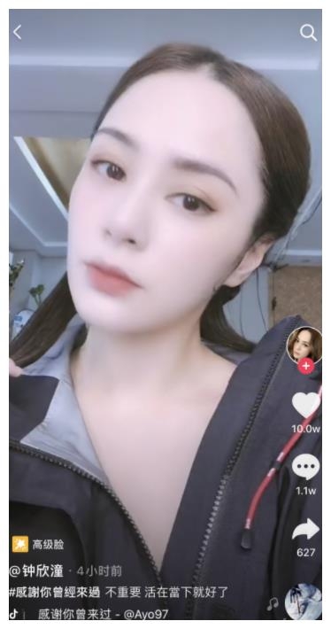 鍾欣潼阿嬌之前在内地拍劇時,就不小心在酒店房内撞傷了右眉骨,傷口達6cm長,最後要縫數十針