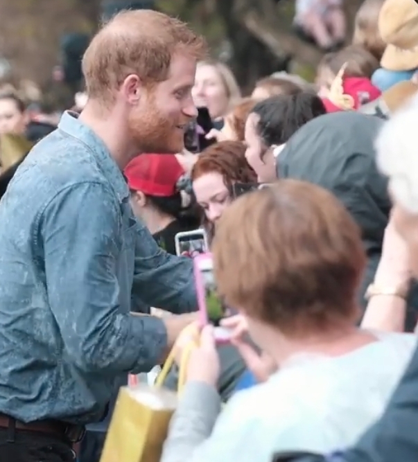 哈里王子脫髮, 威廉王子脫髮, 英國王室, 英國王室脫髮