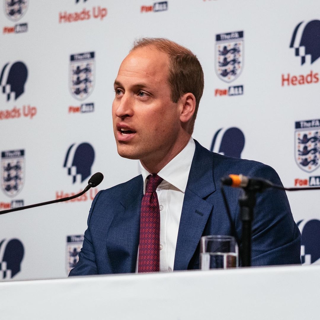 哈里王子脫髮, 威廉王子脫髮, 英國王室, 英國王室脫髮