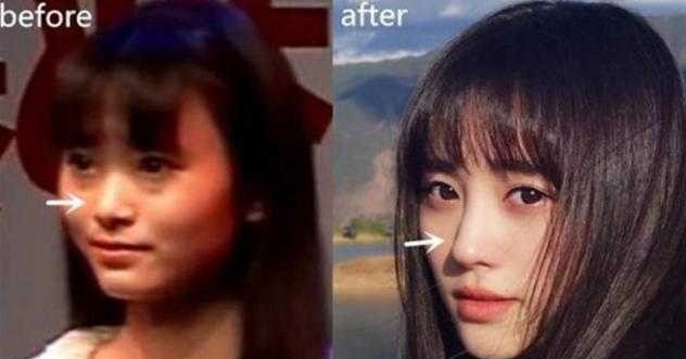 整容|鞠婧煒被網民質疑下頜骨打了瘦臉針,讓整個臉容變得更完美!