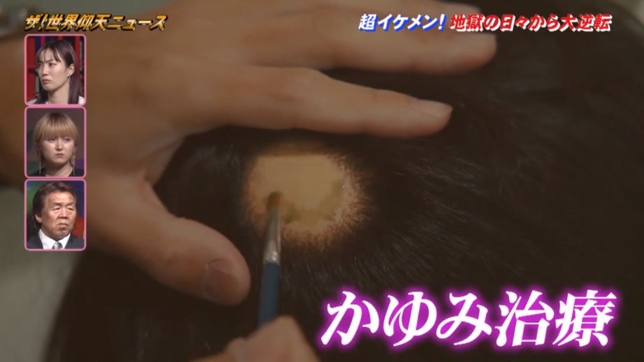 GYUTAE在節目中大方分享自己一路走來的故事,在浮華絕美的IG照片背後,原來隱藏這一個悲慘催淚的故事