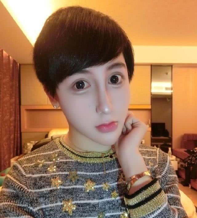 內地網紅劉梓晨因有著不合比例大眼睛、超誇張的尖下巴以堅挺高鼻而被網民稱為「蛇精男」