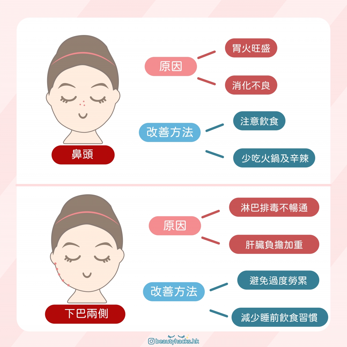 脆弱肌暗瘡大爆發? 臉上敏感泛紅還要生暗瘡?夏天敏感暗瘡肌保養指南!
