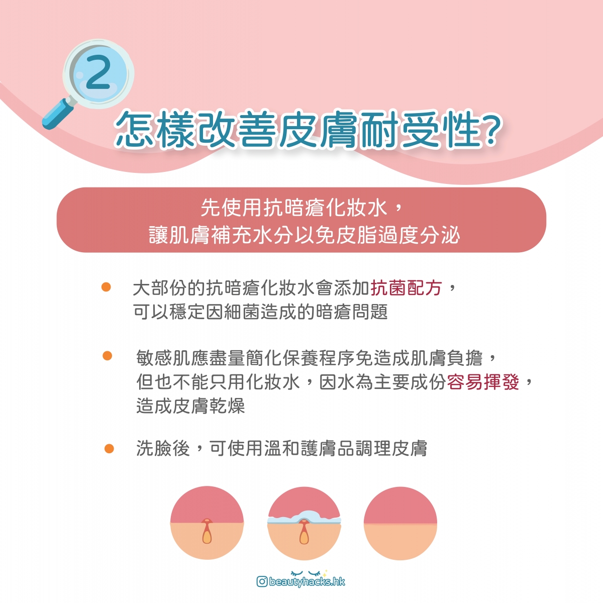 脆弱肌暗瘡大爆發? 臉上敏感泛紅還要生暗瘡?夏天敏感暗瘡肌保養指南!