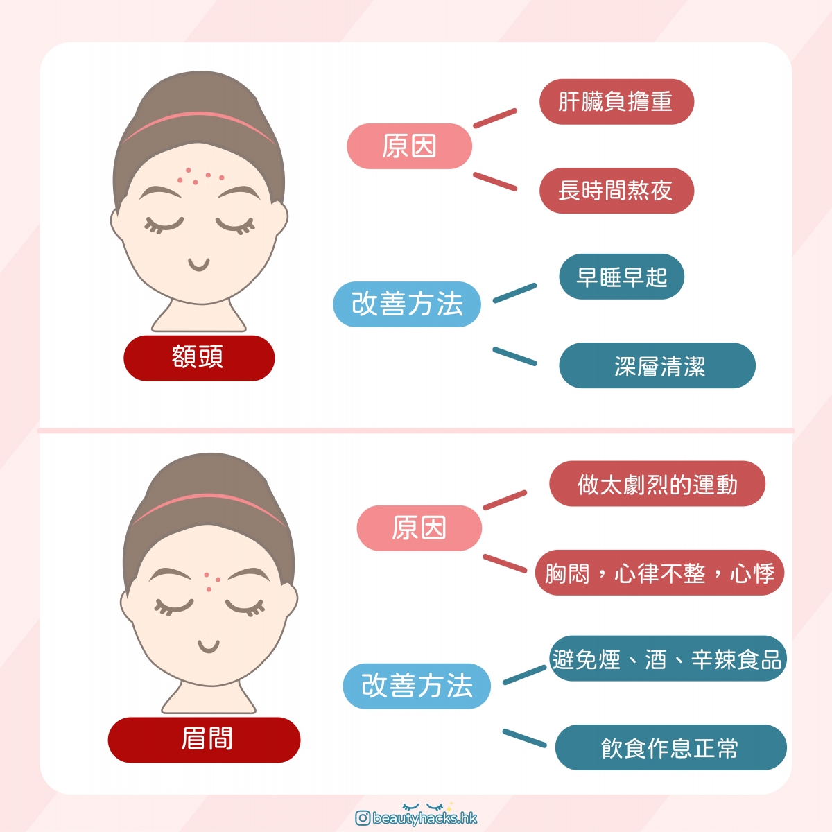 脆弱肌暗瘡大爆發? 臉上敏感泛紅還要生暗瘡?夏天敏感暗瘡肌保養指南!