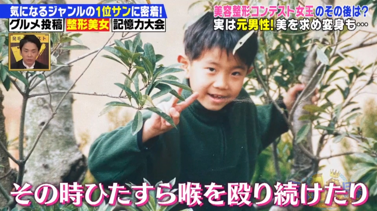 自小就有「性別認同障礙」的馬場汐音，原來自小就對於男生這個身分和身體感到不自在，在變性後還是覺得自己的外貌很男性化