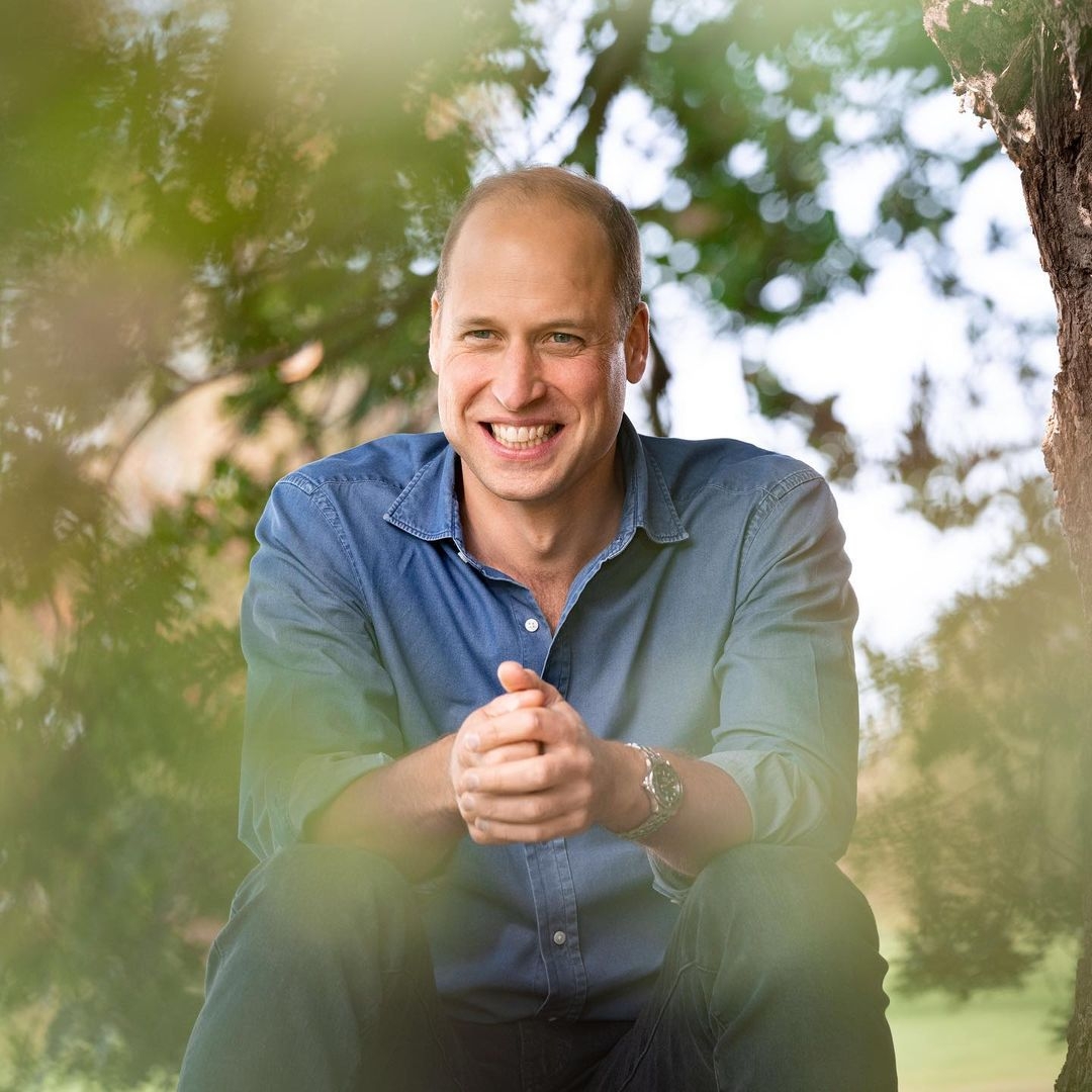 哈里王子脫髮, 威廉王子脫髮, 英國王室, 英國王室脫髮