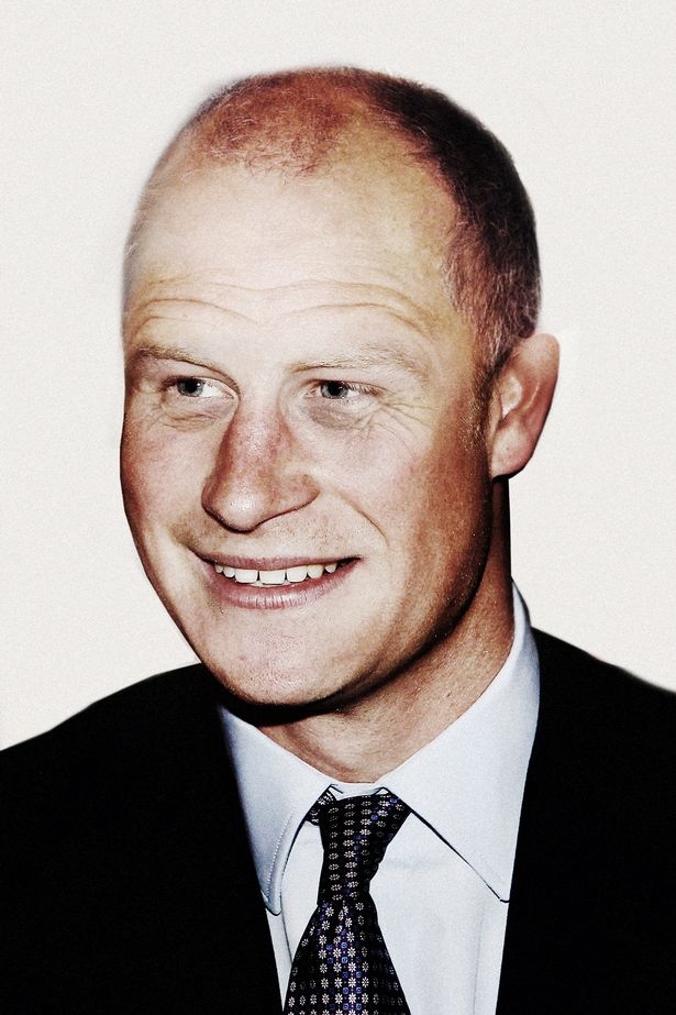 哈里王子脫髮, 威廉王子脫髮, 英國王室, 英國王室脫髮