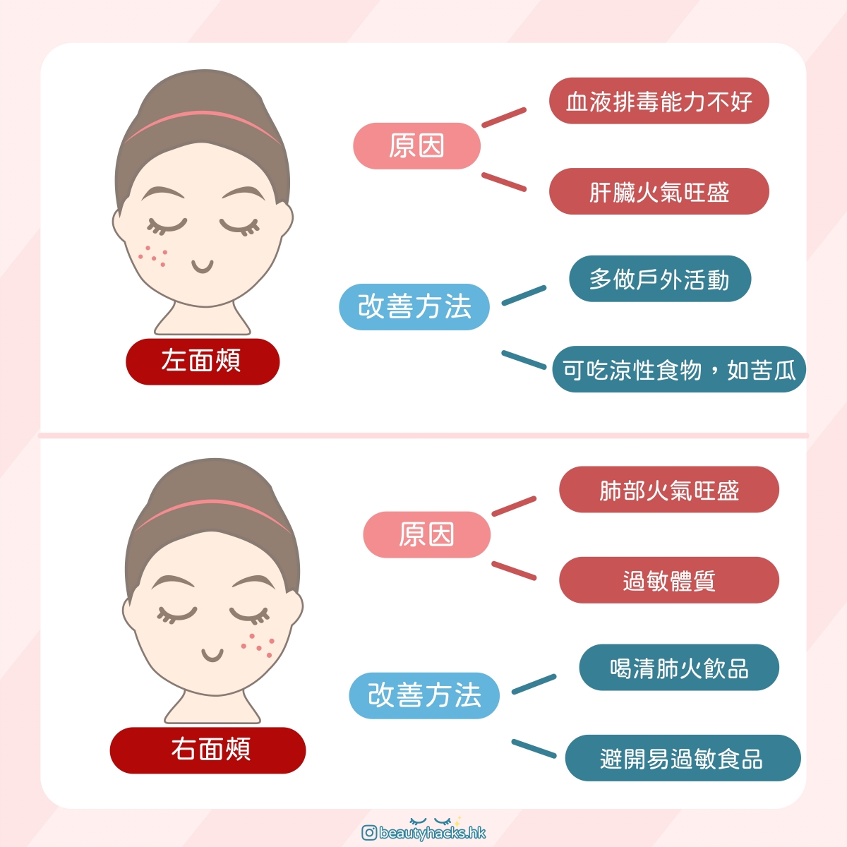 脆弱肌暗瘡大爆發? 臉上敏感泛紅還要生暗瘡?夏天敏感暗瘡肌保養指南!
