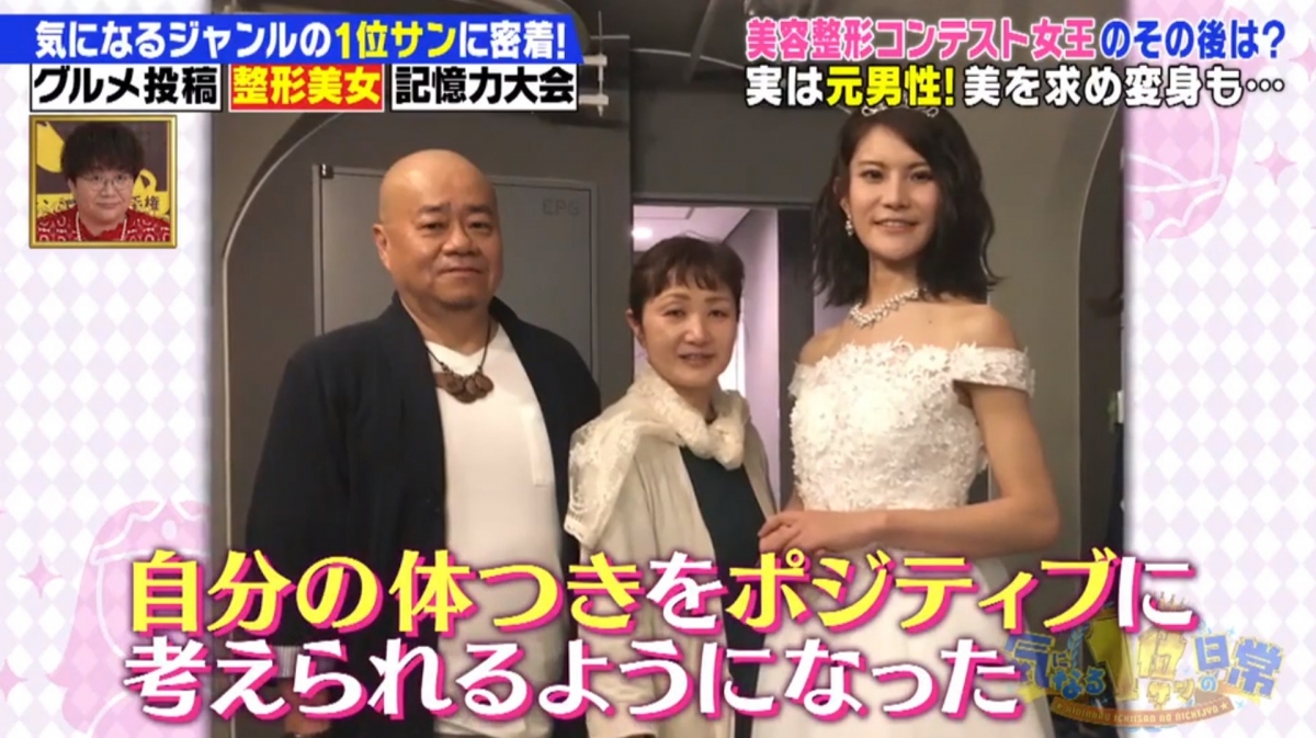 馬場汐音贏得比賽後，就在臉上6個部位動刀，包括眼皮、額頭、腮骨、眉骨和下巴。她的樣貌終於如她所願，變得毫無菱角