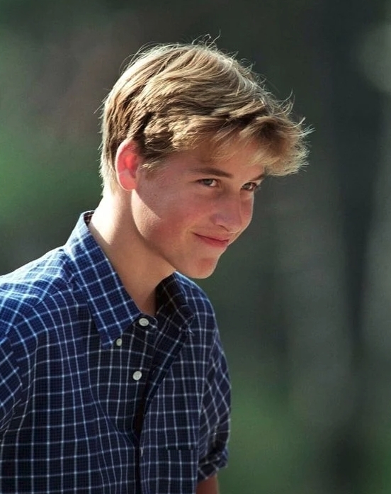 哈里王子脫髮, 威廉王子脫髮, 英國王室, 英國王室脫髮