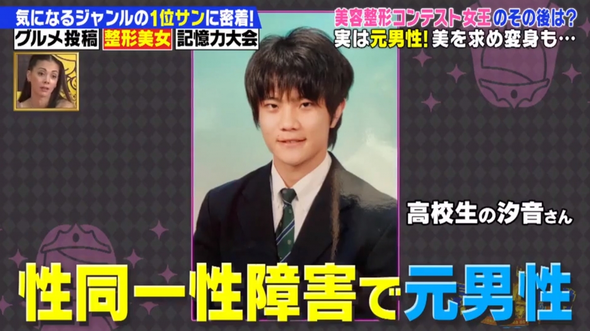 自小就有「性別認同障礙」的馬場汐音，原來自小就對於男生這個身分和身體感到不自在，在變性後還是覺得自己的外貌很男性化