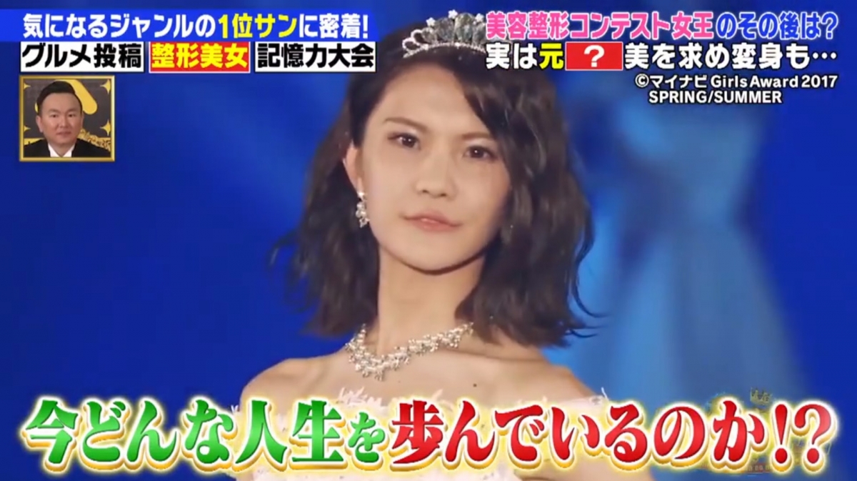 自小就有「性別認同障礙」的馬場汐音，原來自小就對於男生這個身分和身體感到不自在，在變性後還是覺得自己的外貌很男性化