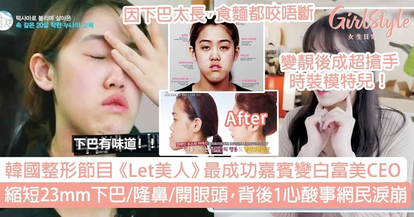 韓國整形節目 Let美人 最成功嘉賓縮短23mm下巴變白富美ceo Girlstyle 女生日常