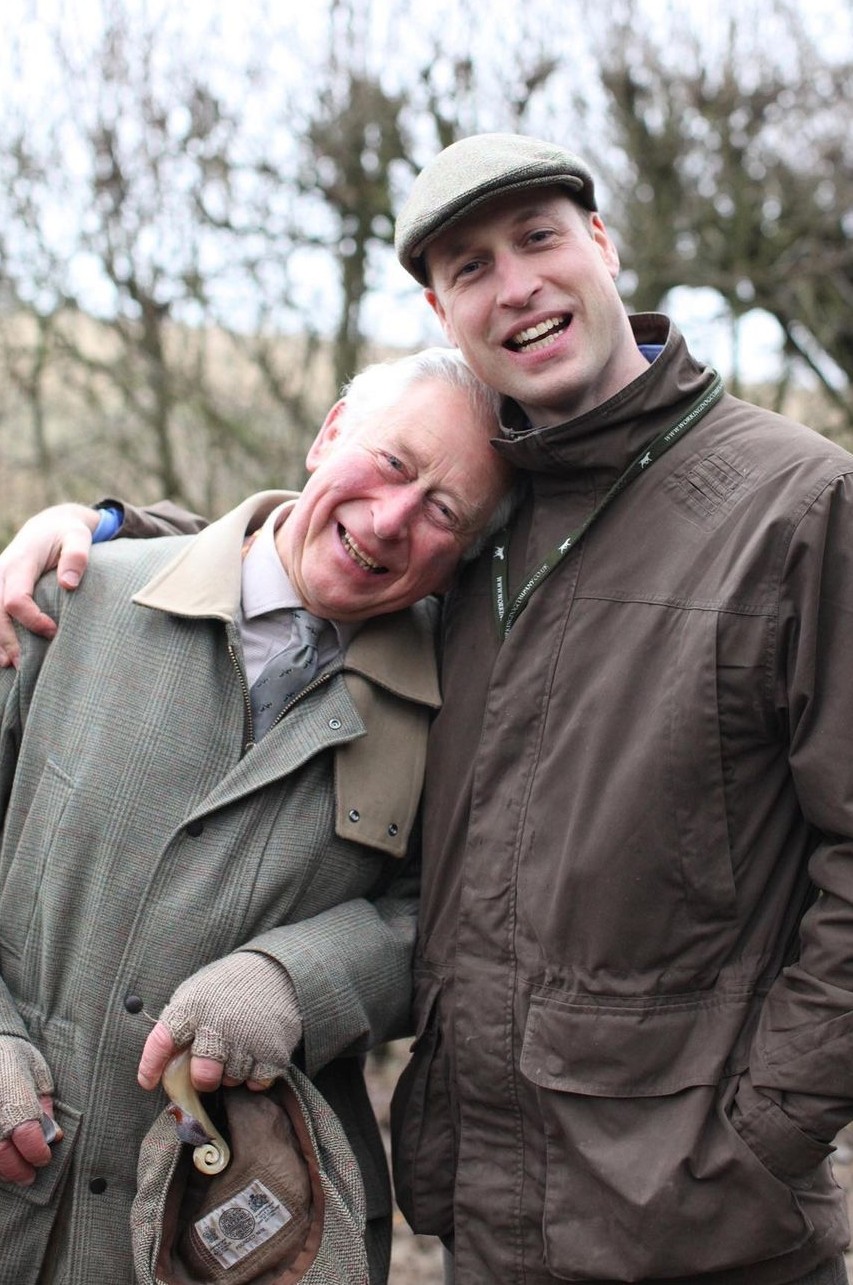 哈里王子脫髮, 威廉王子脫髮, 英國王室, 英國王室脫髮