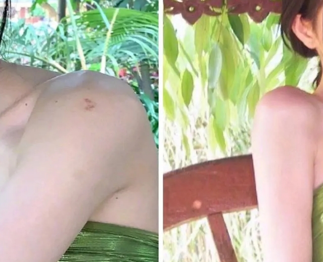 鞠婧禕在幾個月前的照片,發現其中有張相片是可以清楚看到她的肩膀上有瘀青的痕跡