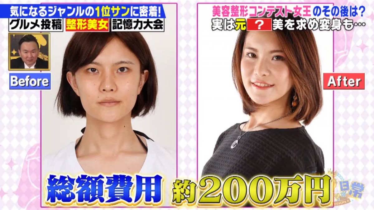 馬場汐音原來在21歲參加比賽之前，花盡積蓄到了泰國進行變性手術，變成一個真正的女孩子。