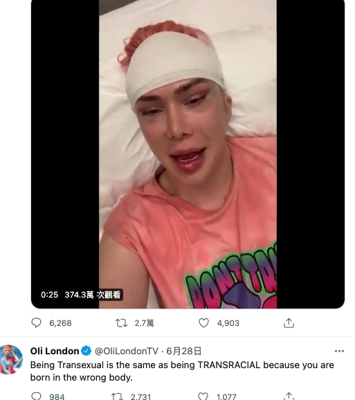 Oli London更認為自己無論內外都是一個韓國人,深信自己的DNA基因中有99%都是韓國人,指自己是跨種族人士,全怪靈魂進錯了身體。