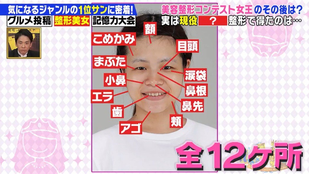 日本整容選美-「尾上七海」豪花了 700 萬日圓(約 52 萬港幣)整容,幾乎全臉大部分位置都有動過刀