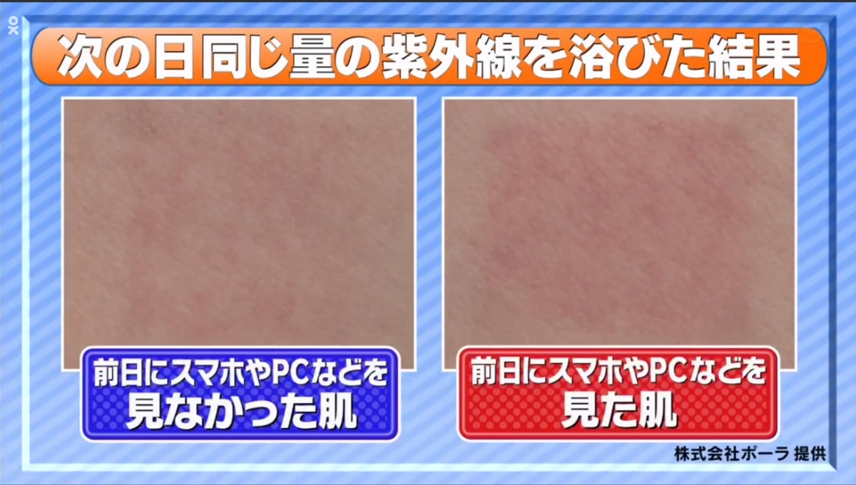 【防曬美白】日本凍齡美容師分享皮膚去暗黃必學貼士!早餐食生果、睡前一舉動都關事?