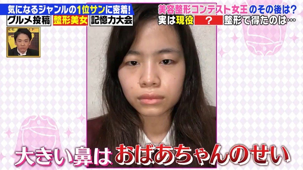 「整容選美大賽」冠軍者「尾上七海」，她從小因為外貌不好看而非常沒有自信心