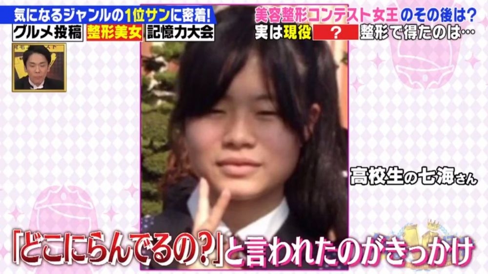 「整容選美大賽」冠軍者「尾上七海」,她從小因為外貌不好看而非常沒有自信心