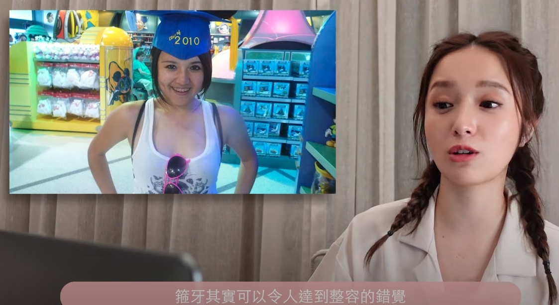 鄺潔楹解釋臉型變尖有可能是因為箍牙的緣故,她更曬出一張自己當時最肥而且正箍牙的照片,憶述自己當時比現在重30磅左右