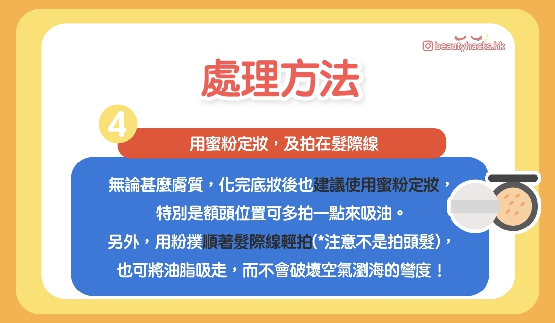 瀏海經常出油怎麼辦?4招教你拯教瀏海!