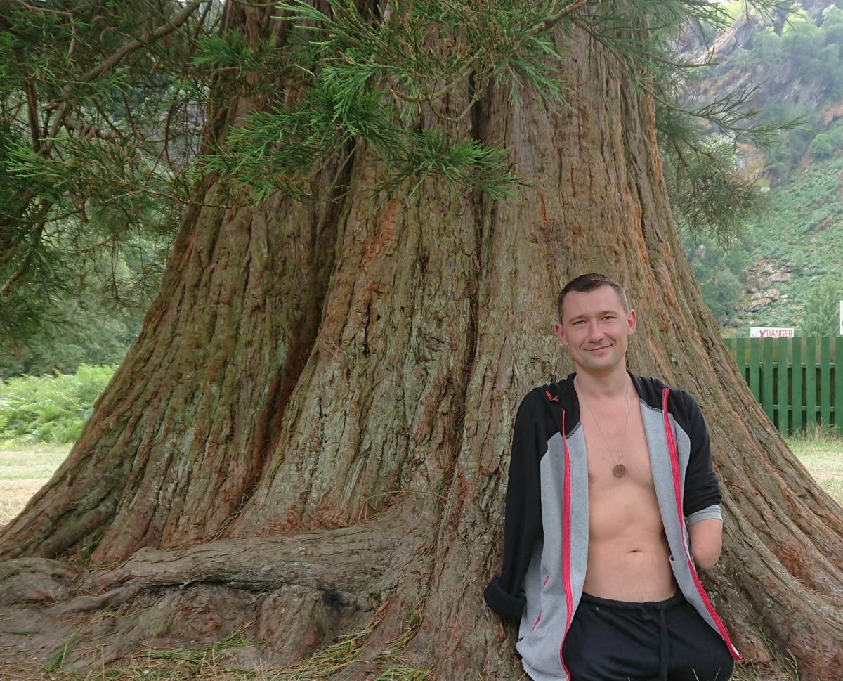 誤踏二戰時期留下的地雷，爆炸的威力令他瞬間失去了雙腿、右手及左前臂