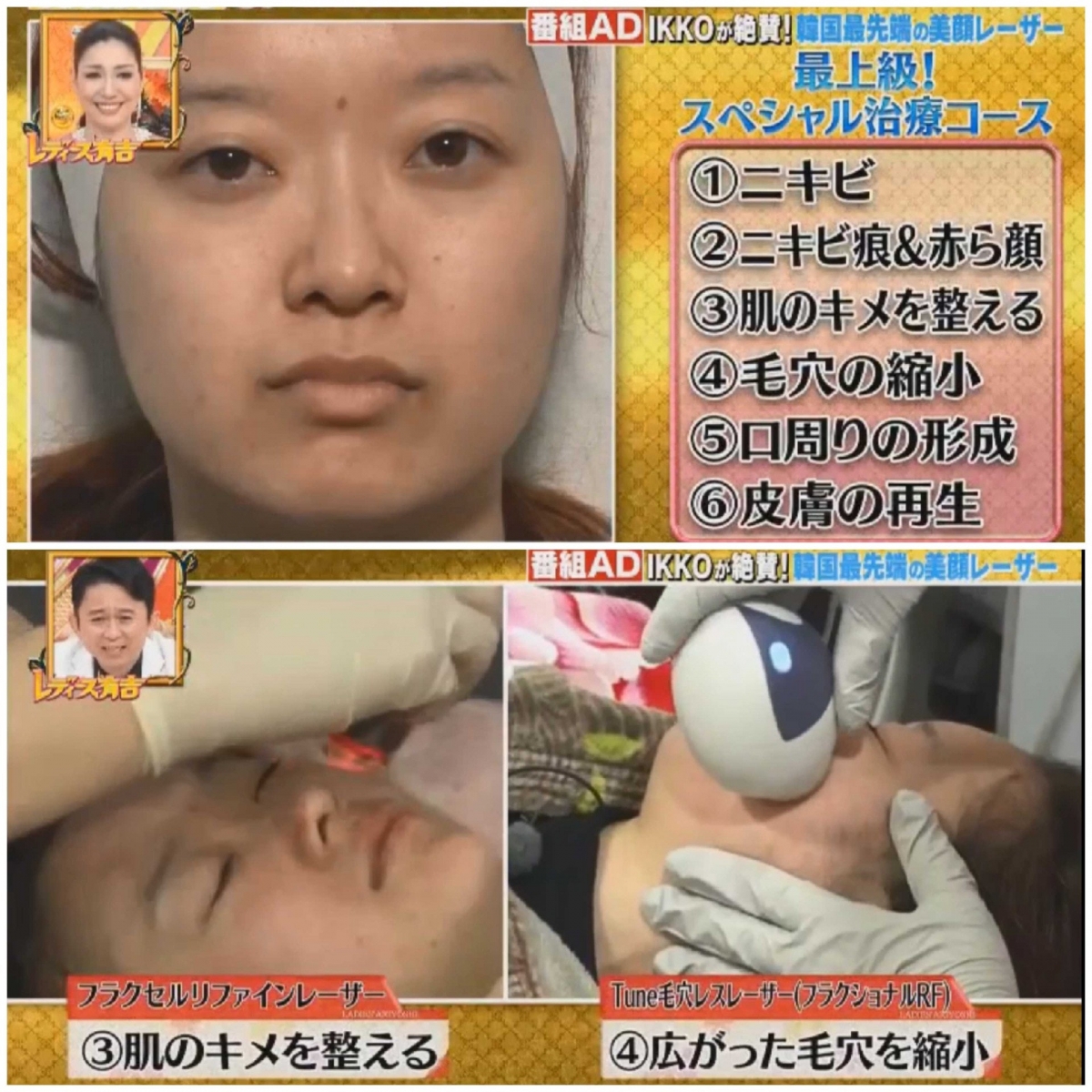 在收到100萬日元資金後,城野感到相當神奇,因為她表示自己從來沒有拿過這麼多現金在手。而她在拿到充裕資金後,就決定立即飛往韓國江南做 treatment「換臉」!