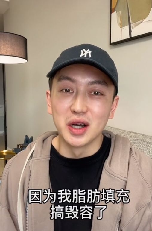 整容手術後的金大威在抖音稱外貌沒預期般好，不甚毀容，臉上皺紋變多
