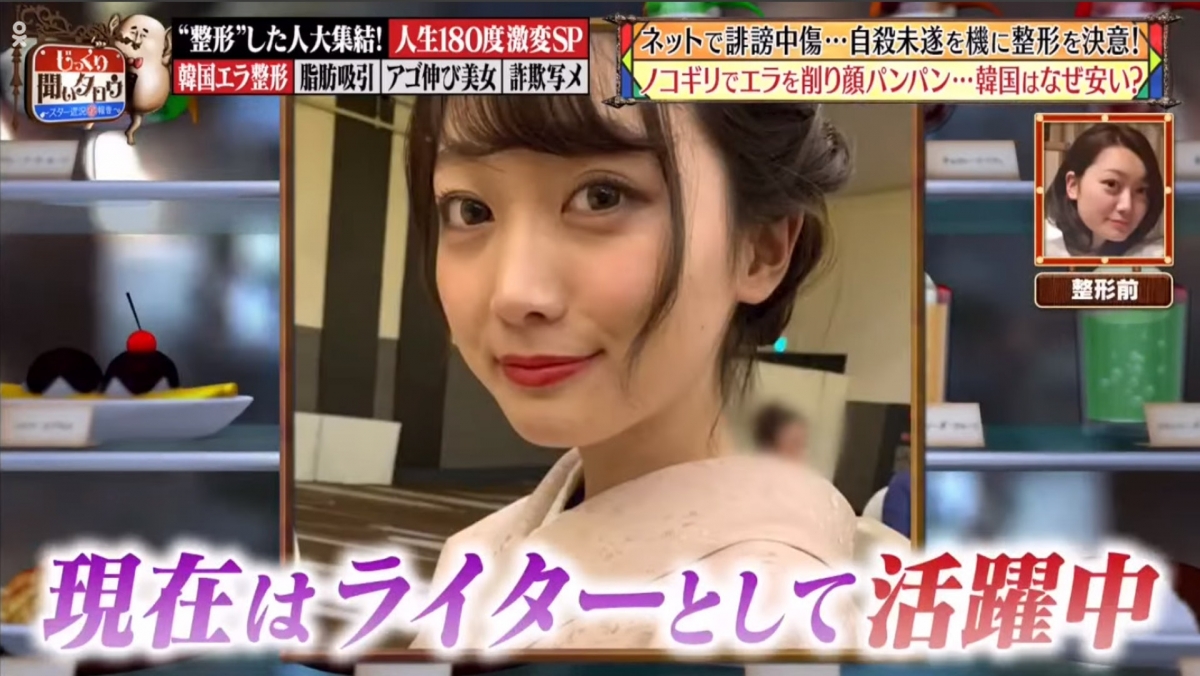 雛野まほ的樣貌氣質都變得更甜美，她的V臉和高鼻子都讓她自信大增。