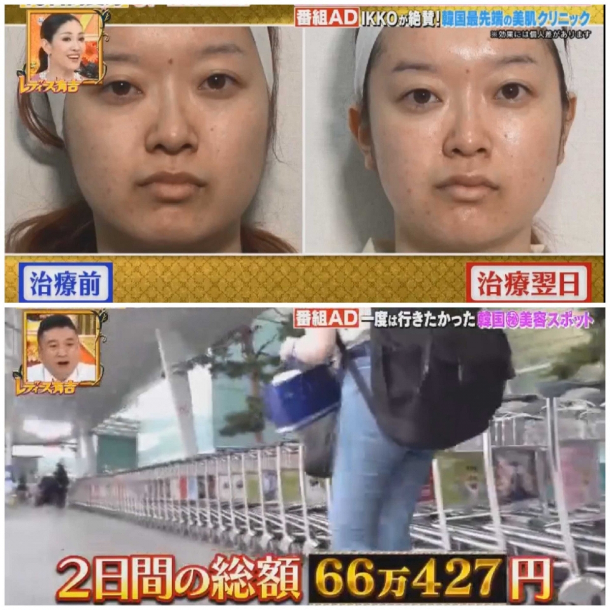 之後,城野小姐更勤力地搽上貴婦級護膚品作保養,一星期後已變得容光煥發!