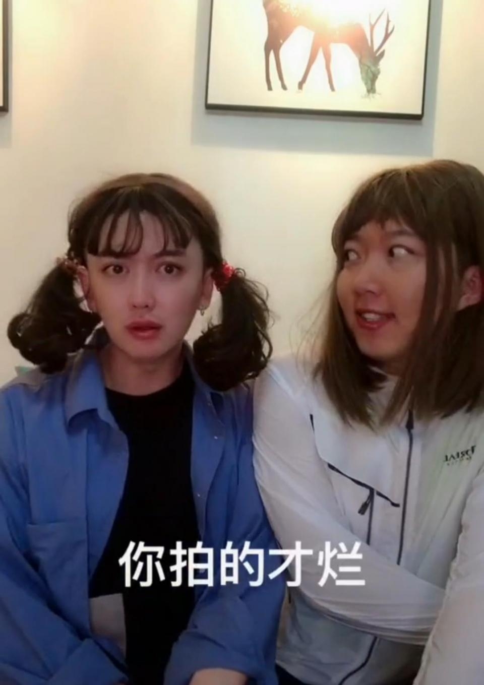 內地人氣網紅金大威整容，雖然憑著帥氣的外貌並搞笑抖音影片吸引不少粉絲的喜愛