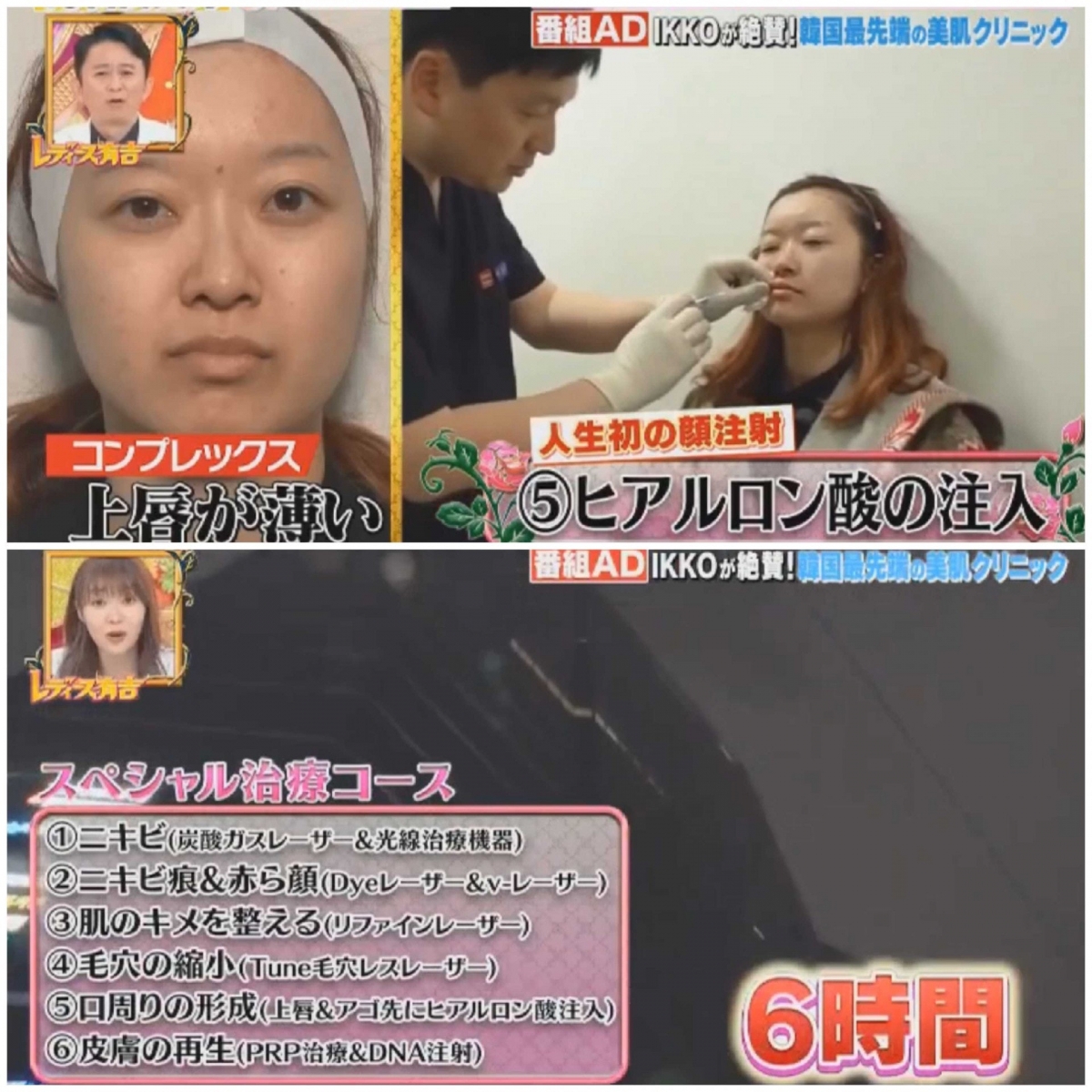 在收到100萬日元資金後,城野感到相當神奇,因為她表示自己從來沒有拿過這麼多現金在手。而她在拿到充裕資金後,就決定立即飛往韓國江南做 treatment「換臉」!