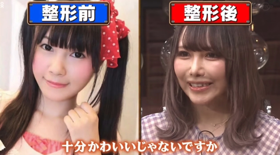 有不少網民甚至 MiRichan 本人，都覺得未整前的樣子並不難看